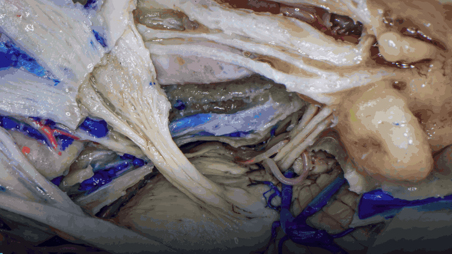 Animated StereoMed AI workflow converting medical imagery into depth-aware stereoscopic content.